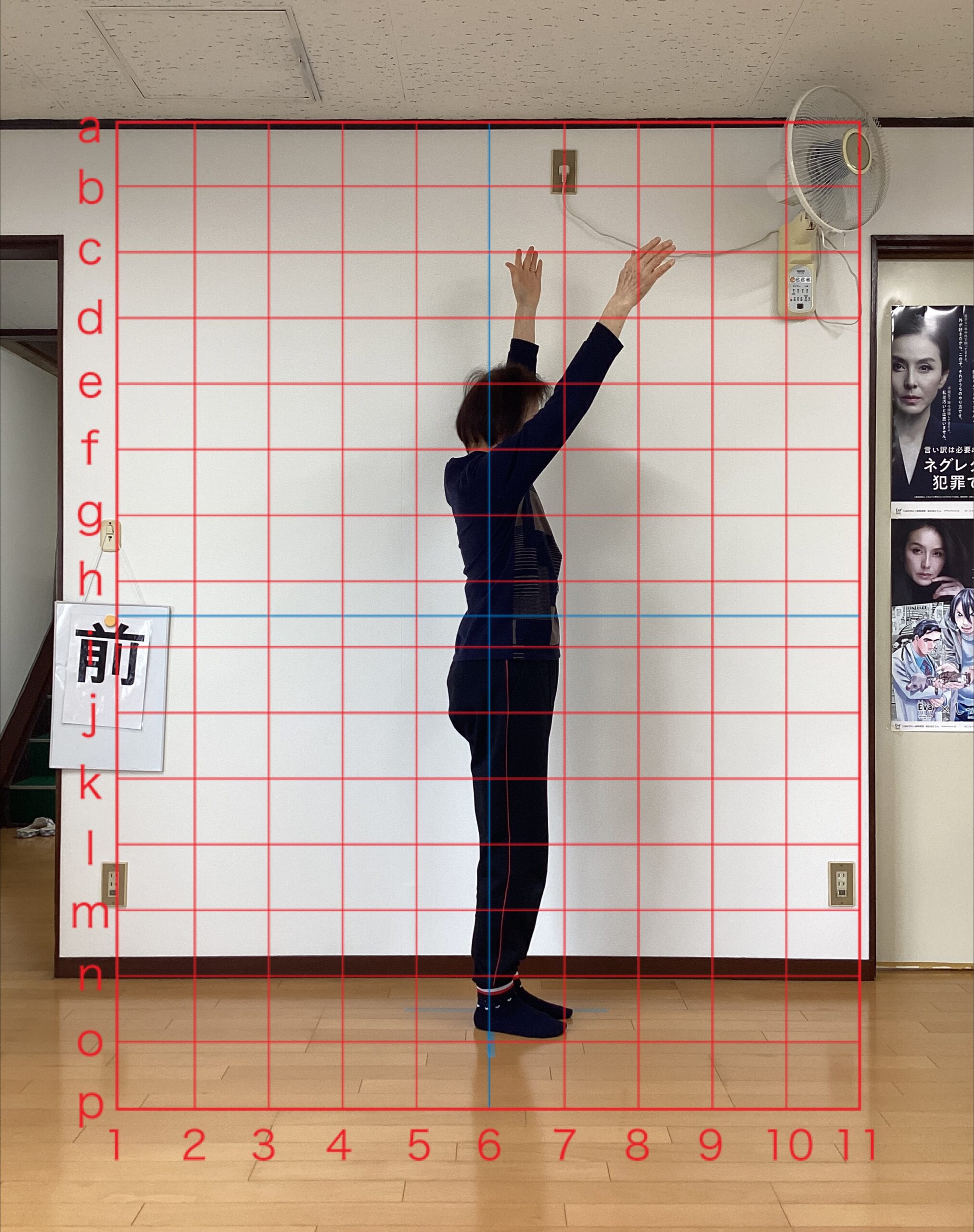 70代女性 施術前